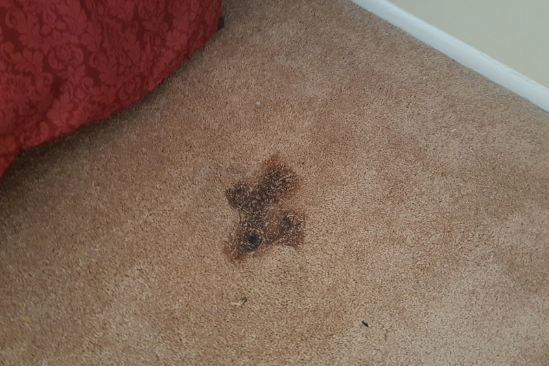 How To Get Rid Of Rug Burn